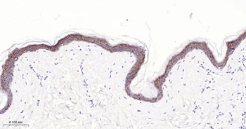 CLDN1 Mouse Monoclonal Antibody