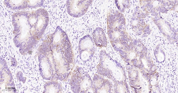 CLDN1 Mouse Monoclonal Antibody