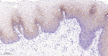 CLDN1 Mouse Monoclonal Antibody