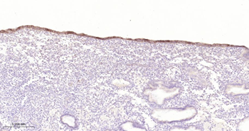 CLDN1 Mouse Monoclonal Antibody
