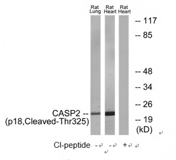 Caspase 2 (p18, Cleaved-Thr325) Antibody