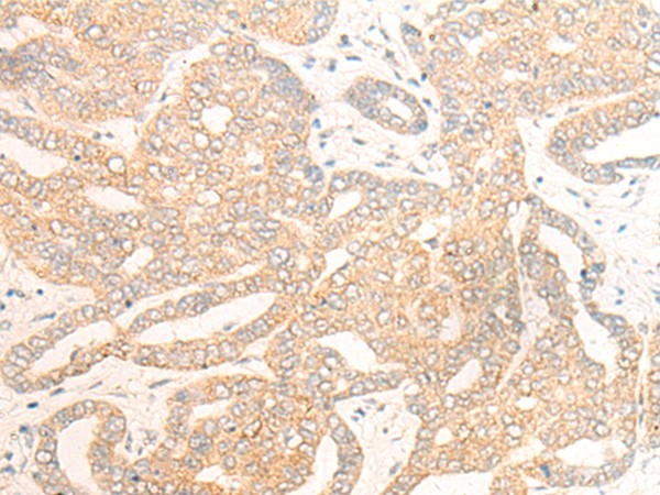 DCAF5 Antibody