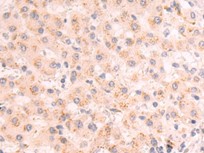 BACH2 Antibody