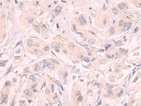 BACH2 Antibody