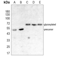 PAR1 Rabbit Polyclonal Antibody