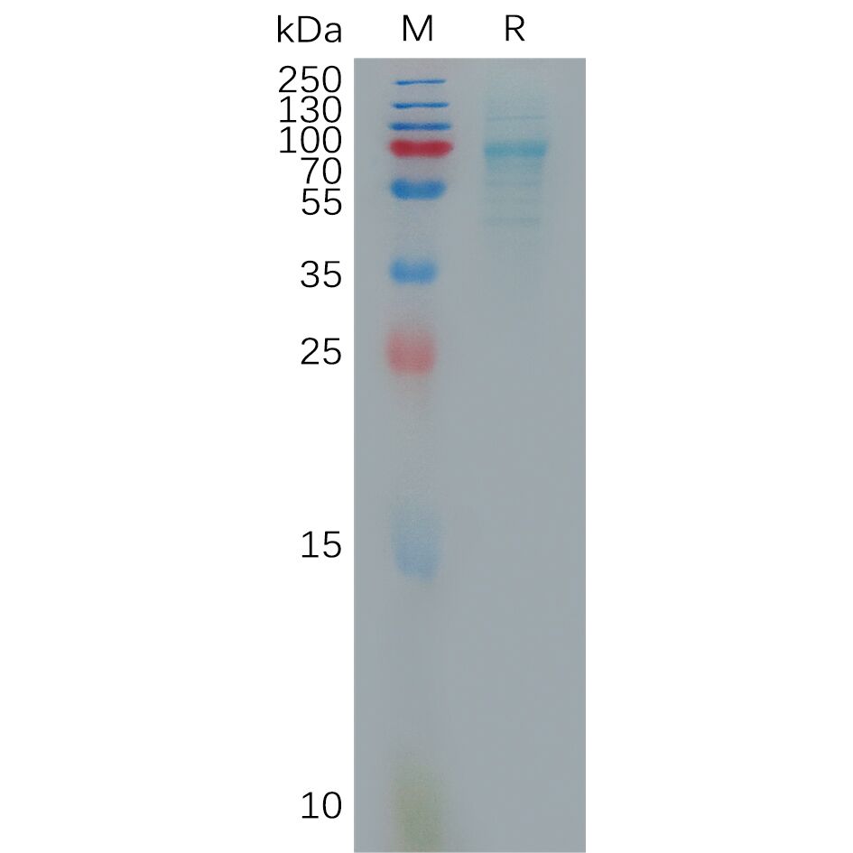 Human CXCL16 Protein, hFc Tag