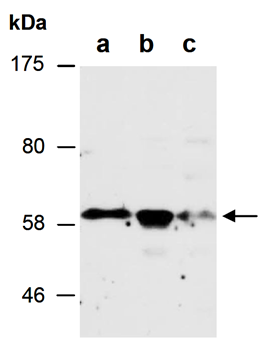 EGR2 (C) Antibody, Rabbit Polyclonal