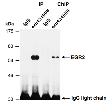 EGR2 (C) Antibody, Rabbit Polyclonal