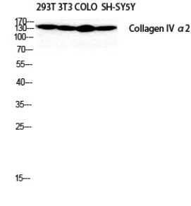 COL4A2 antibody