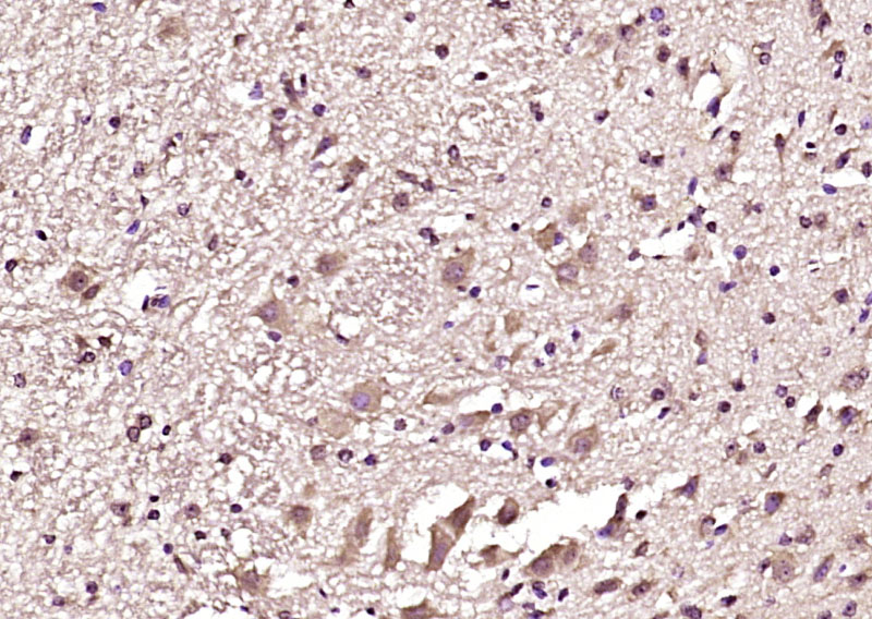 Tau (Phospho-Thr231) Antibody