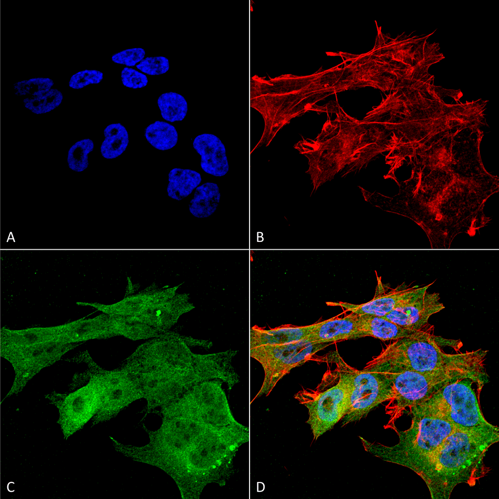 Versican Antibody (FITC)