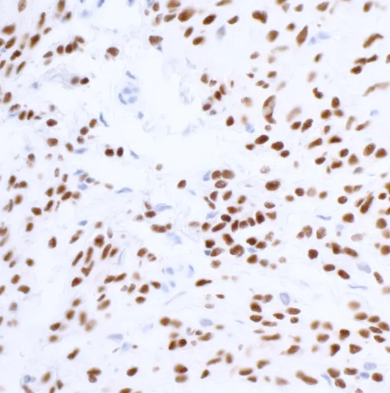 Rabbit anti-SOX10 Recombinant Monoclonal Antibody