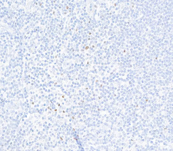Rabbit anti-FOXP3 Recombinant Monoclonal Antibody