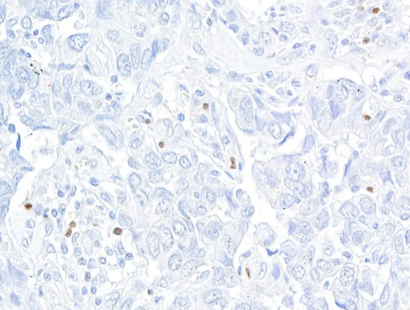 Rabbit anti-FOXP3 Recombinant Monoclonal Antibody