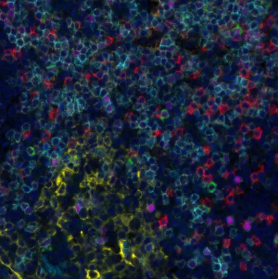 Rabbit anti-LAG3 Recombinant Monoclonal Antibody
