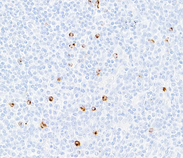 Rabbit anti-LAG3 Recombinant Monoclonal Antibody