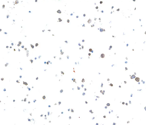 Rabbit anti-LAG3 Recombinant Monoclonal Antibody