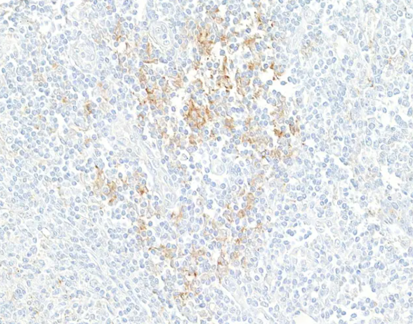 Rabbit anti-PD-L1 Recombinant Monoclonal Antibody