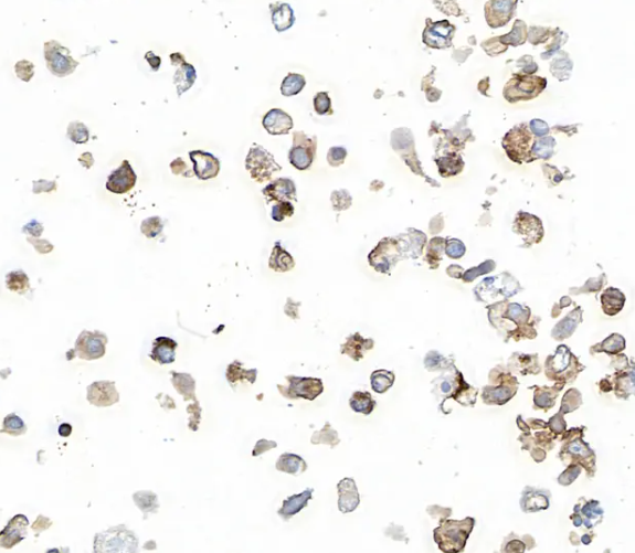 Rabbit anti-PD-L1 Recombinant Monoclonal Antibody