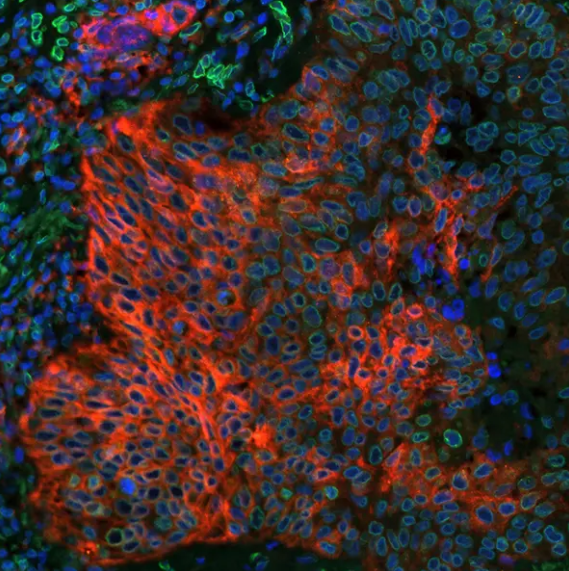 Rabbit anti-PD-L1 Recombinant Monoclonal Antibody
