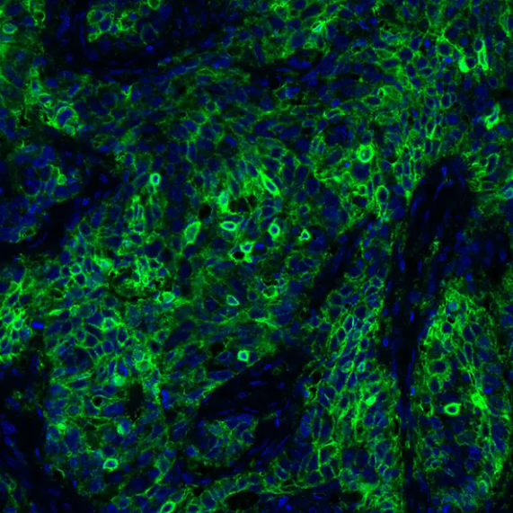 Rabbit anti-PD-L1 Recombinant Monoclonal Antibody