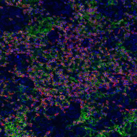 Rabbit anti-PD-L1 Recombinant Monoclonal Antibody