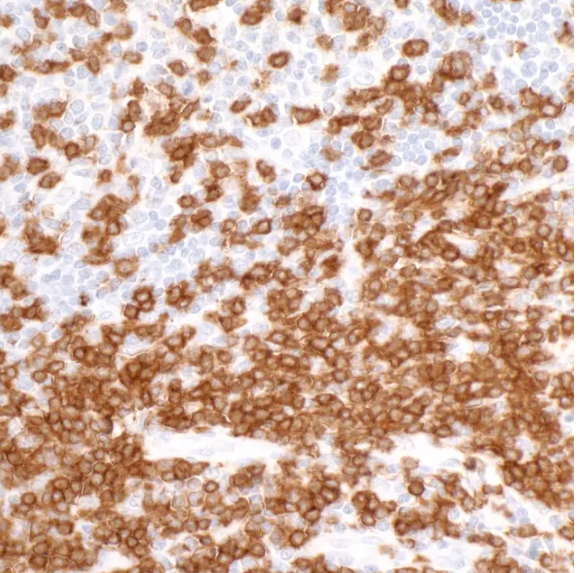 Rabbit anti-CD3E Recombinant Monoclonal Antibody