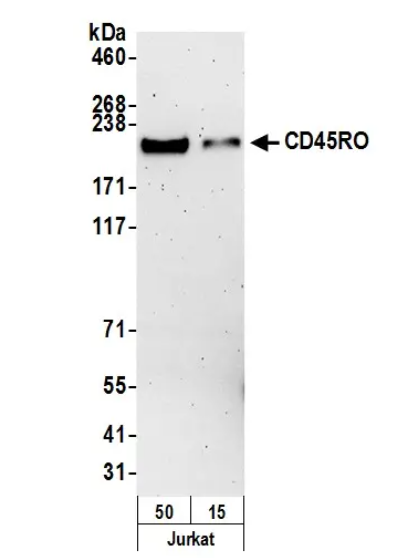 Mouse anti-CD45RO Monoclonal Antibody