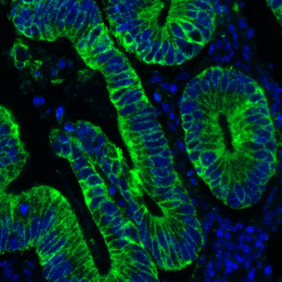 Mouse anti-Cytokeratin Monoclonal Antibody
