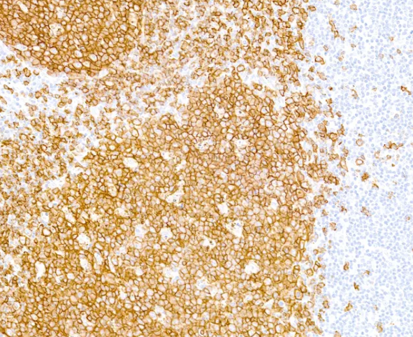 Mouse anti-CD20 Monoclonal Antibody