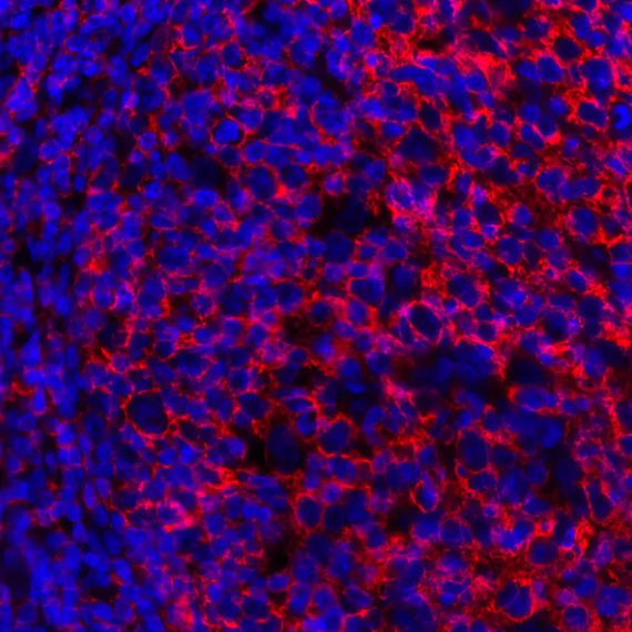 Mouse anti-CD20 Monoclonal Antibody