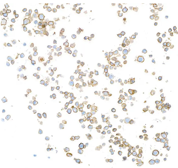 Mouse anti-CD20 Monoclonal Antibody