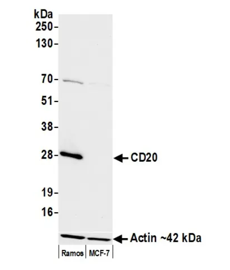 Mouse CD20 Monoclonal Antibody