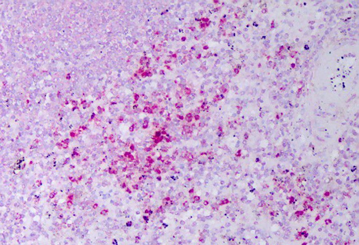 RETN/Resistin Antibody