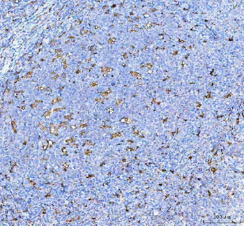 IL18 Rabbit Polyclonal Antibody