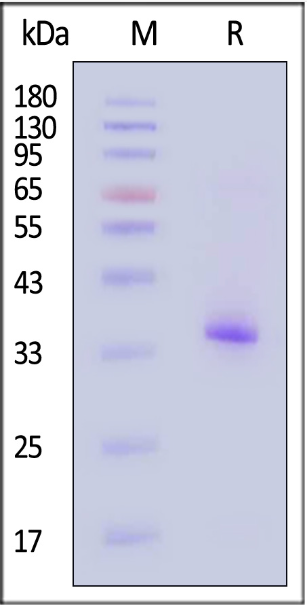 Human FGF-5 Protein, His Tag (SPR verified)