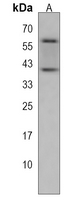 KMO Rabbit Polyclonal Antibody