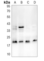 DAPL1 Rabbit Polyclonal Antibody