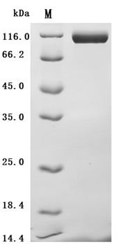 Recombinant Mouse Mast/stem cell growth factor receptor Kit (Kit), partial (Active)