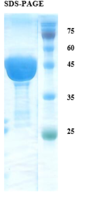 Leishmania K9-26-39 protein