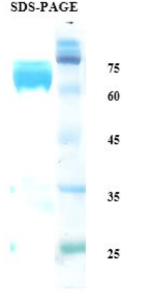 Leishmania K39 protein