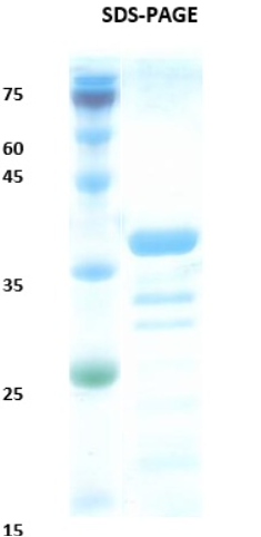 Leishmania K28 Recombinant Protein
