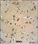 GABRG3 Antibody (N-term)