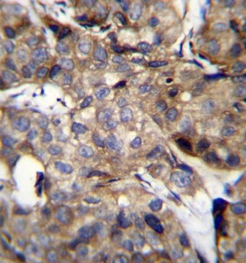 TM4SF1 Antibody (N-term)