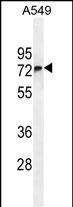 FBXO24 Antibody (Center)