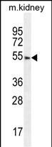 FBXO24 Antibody (Center)