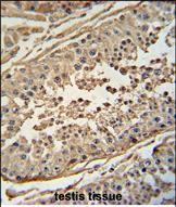FBXO24 Antibody (Center)