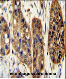 KIAA1324L Antibody (N-term)