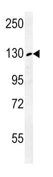 RTL1 Antibody (C-term)