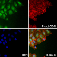 Arginase 1 Rabbit Polyclonal Antibody